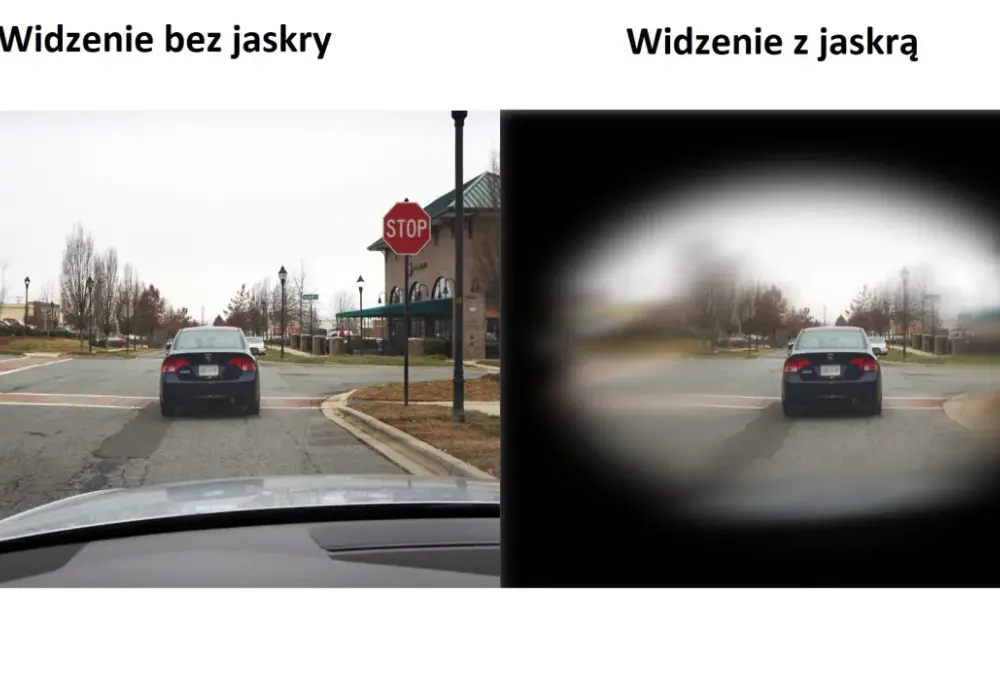 Jaskra a problemy z widzeniem w nocy - dlaczego i jak pomóc?