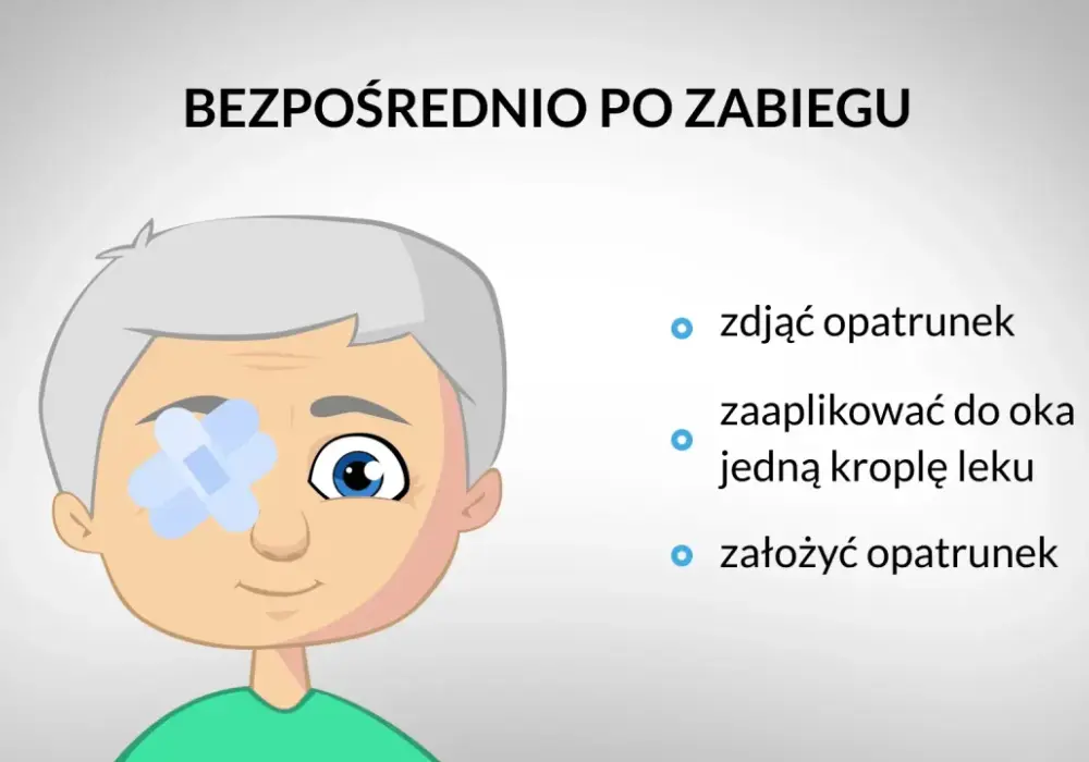 Oglądanie TV po operacji zaćmy - Kiedy i jak bezpiecznie?