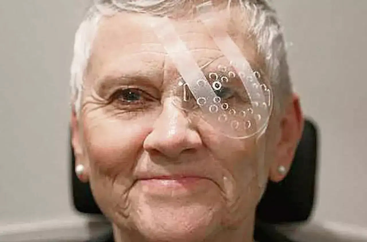 Starsza pani z plastrem na oku po operacji zaćmy. Przezroczysta osłonka chroni świeżo operowane oko.