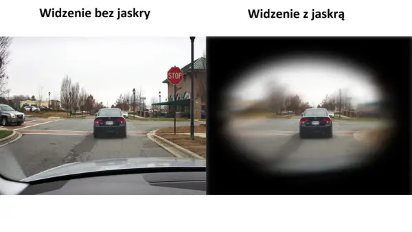 Jaskra a problemy z widzeniem w nocy - dlaczego i jak pomóc?